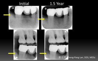 全螢幕擷取 201396 下午 050859