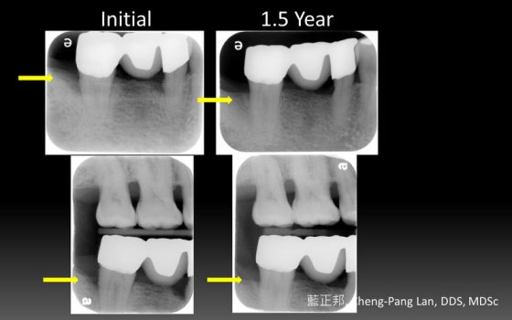 全螢幕擷取 201396 下午 050859