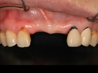 anterior esthetics.002