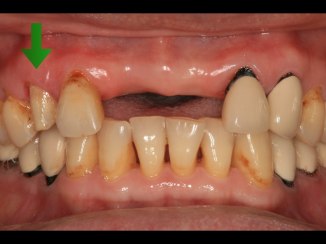 anterior esthetics.004