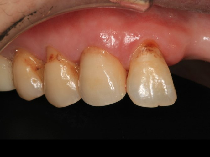 anterior esthetics.006