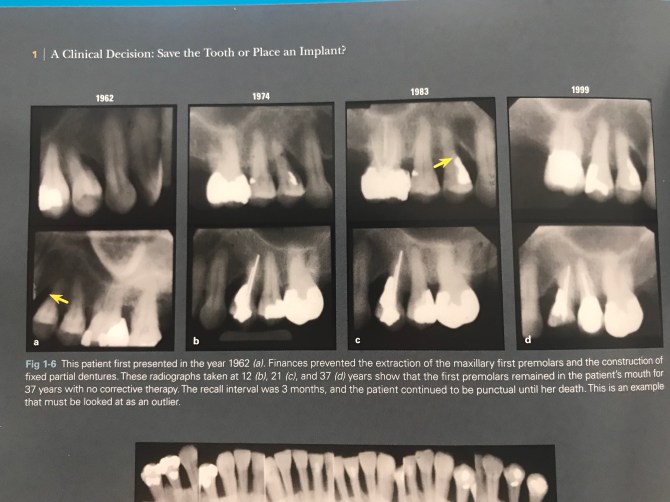 這裡放了一個極特殊的三十年案例，作者稱這叫做「異數」Outlier